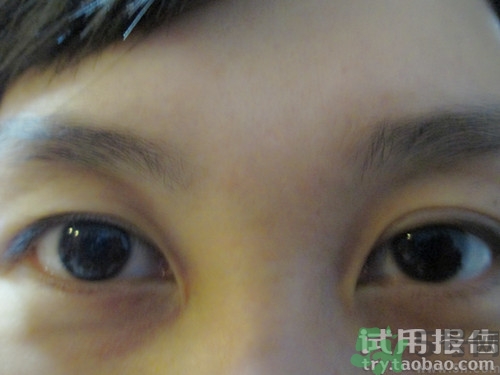蛇毒眼膜效果怎么樣？spa蛇毒眼膜紅色好用嗎？