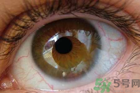 ?干眼癥的治療方法是什么？如何預(yù)防干眼癥？