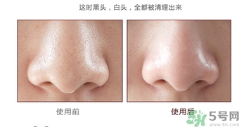 yu.r巧克力棒鼻貼怎么樣？yu.r巧克力鼻貼好用嗎？