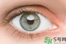 黑眼圈是怎么形成的？黑眼圈是什么原因引起的？