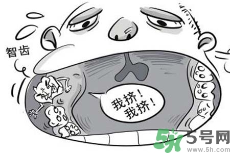 智齒橫著長(zhǎng)怎么辦？智齒橫著長(zhǎng)一定要拔了嗎？