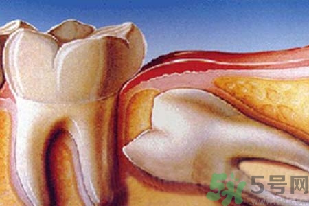 拔智齒一顆多少錢？拔除智齒收費(fèi)多少？