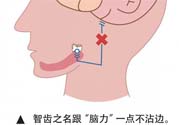 長智齒疼痛怎么辦？長智齒牙齦腫了怎么辦？