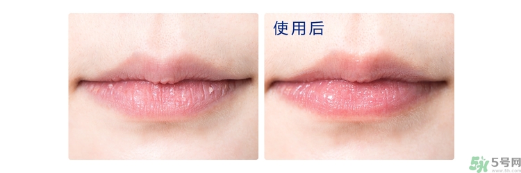 碧唇小藍(lán)罐唇膏孕婦可以用嗎？blistex碧唇小藍(lán)罐專柜價(jià)格