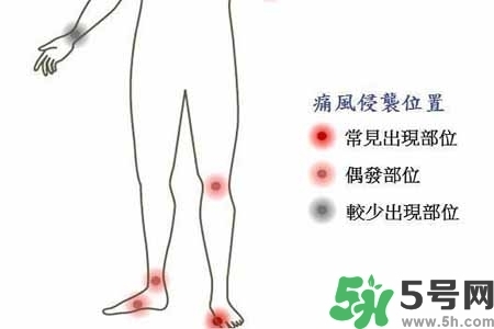 引發(fā)痛風(fēng)的原因是什么？痛風(fēng)病人飲食需注意什么好？