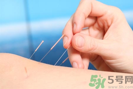 針灸一次要扎多長時(shí)間？針灸可以幾天做一次？