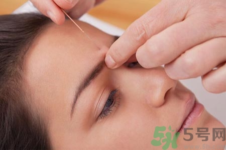 針灸一次要扎多長時(shí)間？針灸可以幾天做一次？