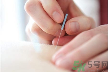 針灸一次要扎多長時(shí)間？針灸可以幾天做一次？