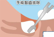 智齒拔完后有個(gè)洞怎么辦？拔智齒后有個(gè)洞多久能長(zhǎng)好？