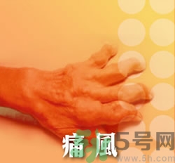 骨關(guān)節(jié)炎能治好嗎？骨關(guān)節(jié)炎平時注意事項