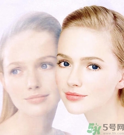 曬斑可以自己消退嗎？曬斑可以用激光去除嗎？