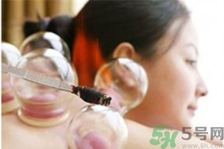 肩膀酸痛可以拔火罐嗎？孕婦肩膀酸痛能拔火罐嗎？