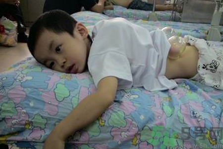 小孩可以拔罐嗎？寶寶能拔火罐嗎？