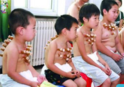 小孩可以拔罐嗎？寶寶能拔火罐嗎？