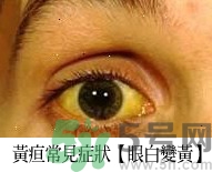 上腹部不舒服有時疼痛會不會是胰臟癌？