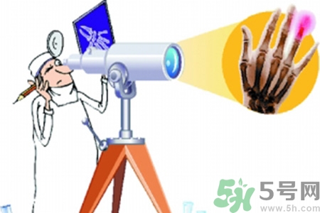什么年齡測骨齡最好？如何測骨齡？