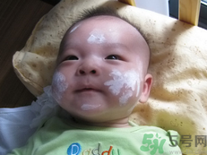 新生兒濕疹可以用爐甘石洗劑嗎？新生兒濕疹的護理措施