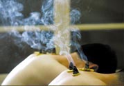 落枕能艾灸嗎？艾灸治療落枕有用嗎？