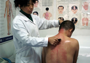 刮痧后什么顏色才健康？刮痧顏色反映的病癥