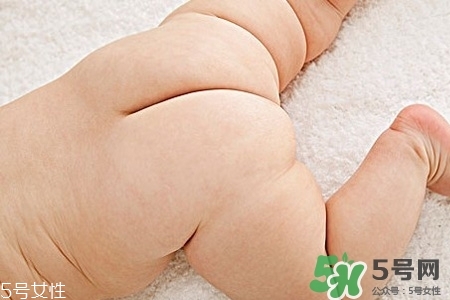擴肛疼嗎？擴肛手術(shù)會很疼嗎？
