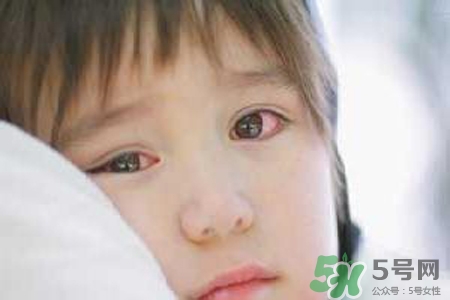孩子為什么老眨眼睛？孩子總眨眼睛怎么回事？