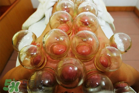 拔罐后皮膚發(fā)癢是怎么回事？拔罐后為什么皮膚會癢？