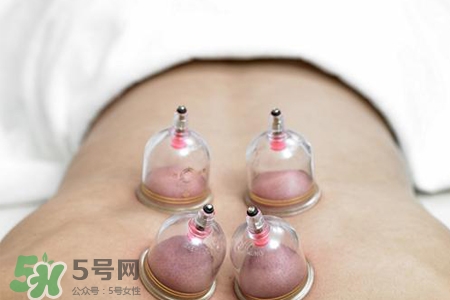 冬天拔罐后多久能洗澡？警惕冬季拔罐后不宜立即洗澡