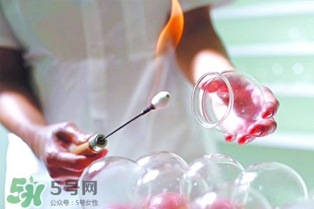 冬天拔罐后多久能洗澡？警惕冬季拔罐后不宜立即洗澡