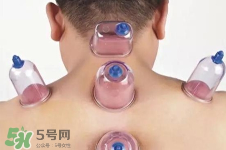 拔罐后可以喝酒嗎？拔罐后多久能喝酒？