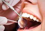 拔牙之后可以吃藥嗎？拔牙之后要不要吃藥？