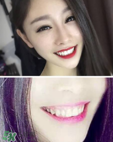 碧緹福冷光牙齒美白儀怎么用？碧緹福冷光牙齒美白儀使用方法