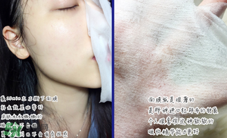 稚優(yōu)泉面膜怎么用？稚優(yōu)泉面膜要洗嗎？