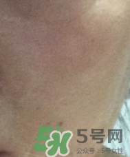 skin1004是什么牌子？skin1004屬于什么檔次