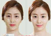skin1004是什么牌子？skin1004屬于什么檔次