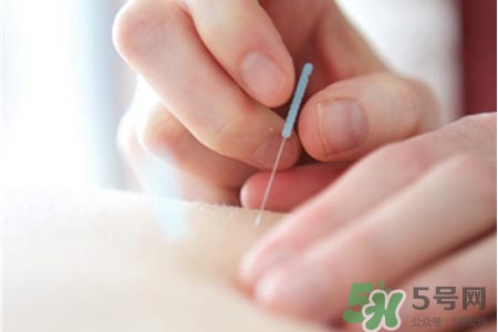 腰間盤突出可以針灸嗎？針灸能治腰間盤突出嗎？
