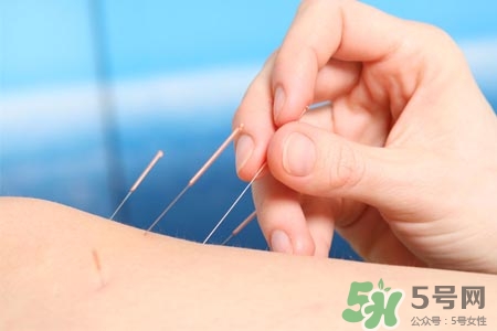腰間盤突出可以針灸嗎？針灸能治腰間盤突出嗎？