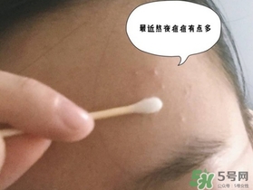 星期四農(nóng)莊茶樹精油怎么用？星期四農(nóng)莊茶樹精油使用方法