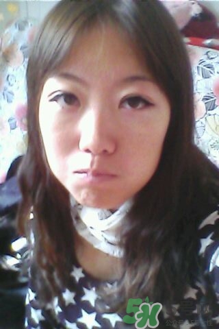 什么是定點(diǎn)雙眼皮？定點(diǎn)雙眼皮多少錢？