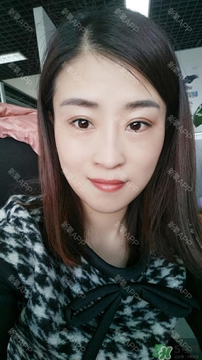 埋線(xiàn)雙眼皮能保持多久？埋線(xiàn)雙眼皮是永久嗎