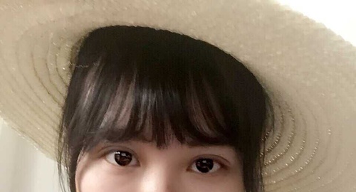 定點(diǎn)雙眼皮恢復(fù)過(guò)程圖_定點(diǎn)雙眼皮要多久恢復(fù)