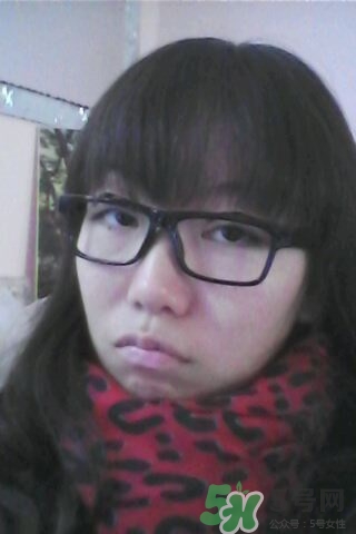 什么是定點(diǎn)雙眼皮？定點(diǎn)雙眼皮多少錢？