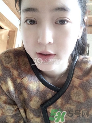 什么是定點(diǎn)雙眼皮？定點(diǎn)雙眼皮多少錢？