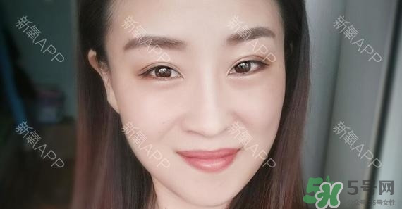 埋線(xiàn)雙眼皮能保持多久？埋線(xiàn)雙眼皮是永久嗎