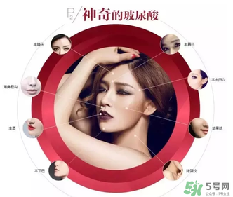 喬雅登是哪個國家的？喬雅登玻尿酸哪個國家？