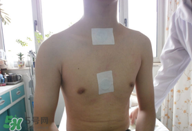 三九貼怎么貼？三九貼的貼法