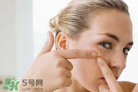 膠原蛋白能祛痘嗎？膠原蛋白可以祛痘嗎？