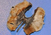核桃分心木多少錢(qián)一斤？核桃分心木價(jià)格