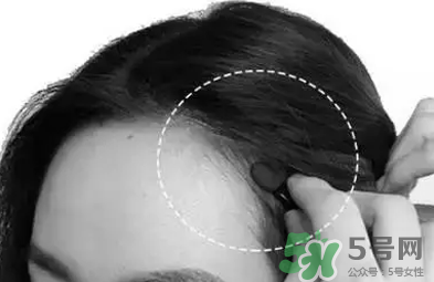 發(fā)際線高適合什么發(fā)型？發(fā)際線高怎么辦