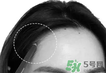發(fā)際線高適合什么發(fā)型？發(fā)際線高怎么辦