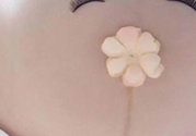 妊娠線每個(gè)孕婦都有嗎？妊娠線出現(xiàn)的時(shí)間